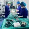 Các bác sĩ thực hiện ca phẫu thuật cho bệnh nhân. (Ảnh: PV/Vietnam+)
