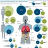 Ung thư - Thách thức lớn về y tế trên toàn thế giới