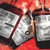 Cảnh báo nguy cơ lây nhiễm viêm gan từ người hiến máu