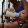 Em bé bị mắc chứng đầu nhỏ được theo dõi tại bệnh viện Oswaldo Cruz, Đông Bắc Brazil. (Nguồn: THX/TTXVN)