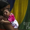 Em bé 1 tháng tuổi mắc chứng đầu nhỏ tại Rio de Janeiro, Brazil. (Nguồn: EPA/TTXVN)