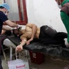 Người dân Syria được điều trị trong bệnh viện ở thị trấn Maaret al-Noman, tỉnh Idlib, sau khi bị ảnh hưởng bởi cuộc tấn công bị tình nghi sử dụng vũ khí hóa học. (Nguồn: EPA/TTXVN)