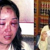 Bà Zhao Yan bị đánh dã man do bị nhầm là một tay buôn lậu ma túy. (Nguồn: shanghaiist.com)