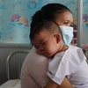 Bệnh nhi mắc bệnh sởi đang điều trị tại Bệnh viện Bệnh Nhiệt đới Thành phố Hồ Chí Minh. (Ảnh: Đinh Hằng/TTXVN)
