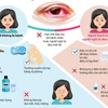 [Infographics] Các biện pháp phòng chống bệnh đau mắt đỏ
