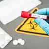 Cộng hòa Séc xác nhận 3 trường hợp nhiễm virus SARS-CoV-2. (Nguồn: AP)