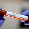 Bhutan xác nhận ca nhiễm virus SARS-CoV-2 đầu tiên. (Nguồn: Reuters)