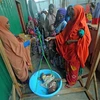 Trẻ em bị suy dinh dưỡng điều trị tại một trung tâm y tế ở ngoại ô Mogadishu, Somalia. (Ảnh: AFP/TTXVN)