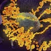 Hình ảnh virus SARS-CoV-2 (màu vàng) nổi lên bề mặt tế bào người. (Ảnh: AFP/TTXVN)