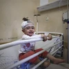 Một em bé Palestine bị thương, sau loạt không kích của Israel xuống Dải Gaza, được điều trị tại bệnh viện Al-Shifa. (Ảnh: AFP/TTXVN)