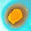 Hình ảnh virus đậu mùa khỉ dưới kính hiển vi điện tử. (Ảnh: Cơ quan an ninh y tế Anh/TTXVN)