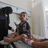Trẻ em bị thương do trúng đạn pháo được điều trị tại bệnh viện ở Al-Bab, tỉnh Aleppo, Syria. (Ảnh: AFP/TTXVN)