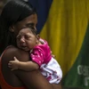 Em bé 1 tháng tuổi mắc chứng đầu nhỏ tại Rio de Janeiro của Brazil. (Ảnh: EPA/TTXVN)
