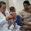 Trẻ em mắc chứng đầu nhỏ do nhiễm virus Zika. (Ảnh: AFP/TTXVN)