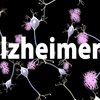 Trung Quốc: ​Phát hiện hai biến thể gene mới gây bệnh Alzheimer 