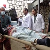 Chuyển nạn nhân sau một vụ tấn công ở thành phố Maidan Shar, tỉnh Wardak của Afghanistan. (Ảnh: AFP/TTXVN)