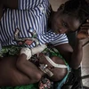 Bệnh nhân nhiễm HIV điều trị tại bệnh viện ở Bangui của Cộng hòa Trung Phi. (Ảnh: AFP/TTXVN)