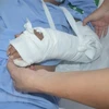 Bệnh viện Đa khoa Trung ương Cần Thơ tiến hành cuộc vi phẫu để cấp cứu thành công một trường hợp bệnh nhân nam, 32 tuổi bị đứt lìa cổ tay trái. (Ảnh: TTXVN phát)