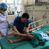 Nạn nhân bị thương đang được điều trị tại Bệnh viện Đa khoa tỉnh Hà Giang. (Ảnh: Minh Tâm/TTXVN)