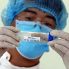 Trung tâm Giám định ADN sẽ có năng lực phân tích 4.000 mẫu hài cốt liệt sỹ mỗi năm. (Ảnh: PV/Vietnam+)