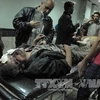 Nạn nhân một vụ đánh bom xe ở Damascus (Nguồn: AGP/TTXVN)