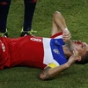Chùm ảnh những pha chấn thương "đẫm máu" tại World Cup 2014 