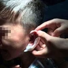 Bác sỹ xác nhận cậu bé bị đâm vào vành tai. (Nguồn: Chinadaily)
