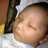 Em bé bị mù một bên mắt vì đèn flash. (Nguồn: dailymail.co.uk)
