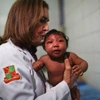 Tiến sỹ Angela Roch, chuyên gia về bệnh truyền nhiễm ở trẻ nhỏ đang xét nghiệm cho một bé 2 tháng tuổi mắc chứng đầu nhỏ. (Nguồn: Reuters)