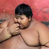[Photo] Cuộc sống của cậu bé 10 tuổi béo nhất thế giới