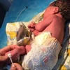Em bé đang được chăm sóc tại bệnh viện. (Nguồn: xinhuanet.com)