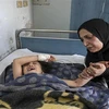 Một em bé bị thương trong cuộc xung đột điều trị tại bệnh viện gần thị trấn Ras al-Ain, Syria, ngày 18/10. (Nguồn: AFP/TTXVN) 