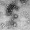 Virus corona mới, được cho là nguyên nhân gây ra dịch viêm phổi lạ tại Vũ Hán, Trung Quốc. (Nguồn: Yonhap/TTXVN) 