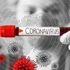 Bảng cảnh báo về virus corona. (Nguồn: IRNA/TTXVN) 