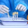 Lấy mẫu xét nghiệm RT-PCR. (Nguồn: TTXVN) 