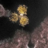 Hình ảnh quét qua kính hiển vi điện tử cho thấy virus SARS-COV-2 trên mẫu bệnh phẩm của bệnh nhân COVID-19. (Ảnh: AFP/TTXVN) 
