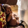 Bệnh nhân mắc đậu mùa khỉ được điều trị tại trung tâm cách ly ở Zomea Kaka thuộc vùng Lobaya, Cộng hòa Trung Phi, ngày 18/10/2018. (Ảnh: AFP/TTXVN) 