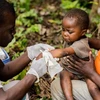 Bác sỹ khám cho một em bé mắc bệnh đậu mùa khỉ tại Zomea Kaka, Cộng hòa Trung Phi. (Ảnh: AFP/TTXVN) 