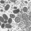 Hình ảnh virus đậu mùa khỉ dưới kính hiển vi điện tử. (Nguồn: AFP/TTXVN) 