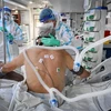 Điều trị cho bệnh nhân nhiễm COVID-19 tại bệnh viện ở Bucharest, Romania. (Ảnh: AFP/TTXVN) 