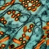 Các hạt virus cúm gia cầm H5N1 (màu cam) dưới kính hiển vi. (Nguồn: Statnews)