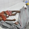 Nạn nhân bị thương sau vụ giẫm đạp tại bang Uttar Pradesh, Ấn Độ được điều trị tại bệnh viện ngày 3/7/2024. (Ảnh: THX/TTXVN)
