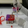 Công tác nghiên cứu về bệnh HIV/AIDS đang có nhiều tiến triển. (Nguồn: Getty)
