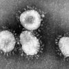 Virus corona. (Nguồn: theconversation)