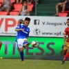 Tiền vệ Hải Huy lạc quan sau chấn thương nặng ở vòng 3 V-League chiều 6/6 trước đối thủ Hồng Lĩnh Hà Tĩnh. (Ảnh: VFF) 