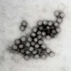 Siêu vi khuẩn norovirus. (Ảnh: Internet)