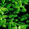 Vi khuẩn E.coli. (Nguồn: inhabitat.com)