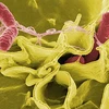 Vi khuẩn Salmonella. (Nguồn: Space.com)