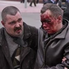 Hỗ trợ người bị thương trong vụ nổ ngày 11/4. (Ảnh: AFP/TTXVN)
