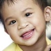 Mang lại "nụ cười mới" cho trẻ em hở hàm ếch (Ảnh: Internet)